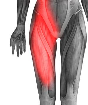 Hip Flexor Pain